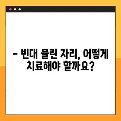 빈대 물렸을 때 꼭 알아야 할 4가지 증상과 대처법 | 빈대, 물림 증상, 치료, 예방